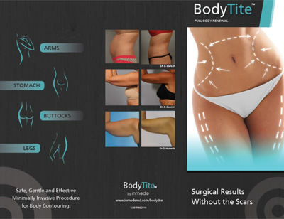 BodyTite Liposuction patient procedure