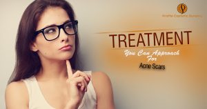Treatment You Can Approach For Acne Scars