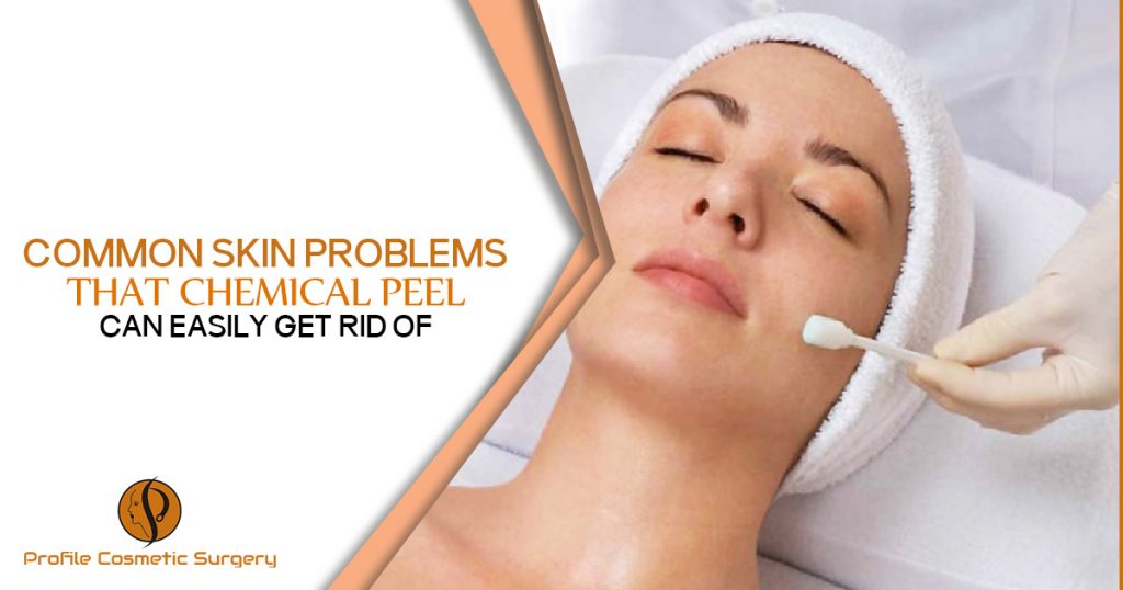 Common-Skin-Problems-that-Chemical-Peel-can-easily-get-rid-of