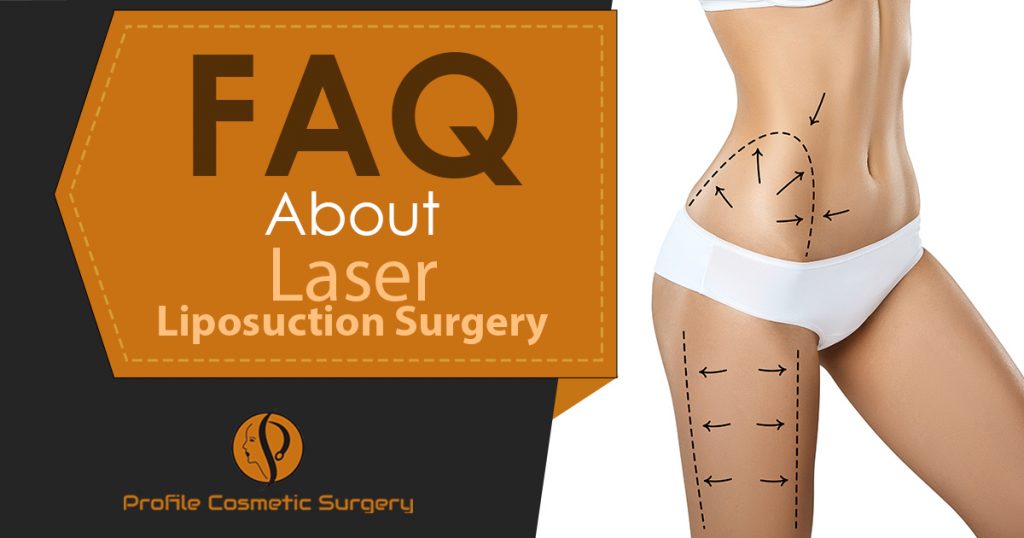 FAQ-About-Laser-Liposuction-Surgery