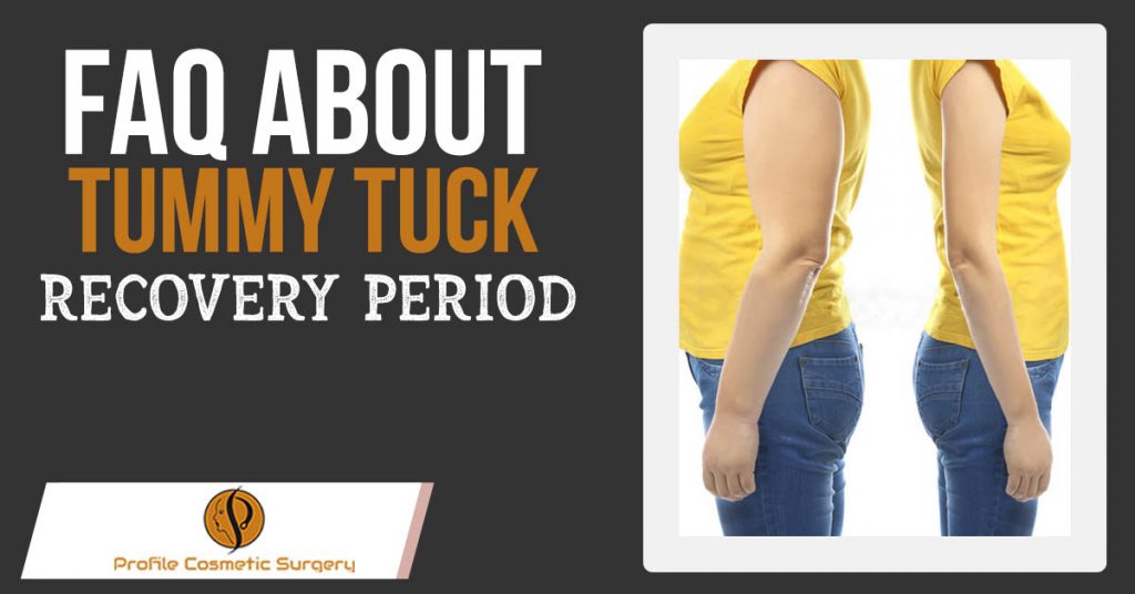 FAQ About Tummy Tuck recovery period