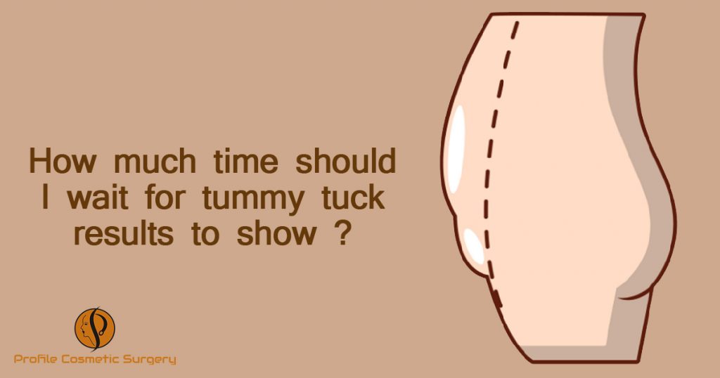 How much time should i Wait for tummy tuck results to show