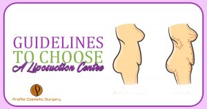 Guidelines to choose A Liposuction Centre