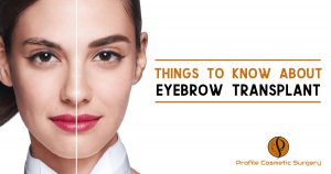 Things To Know About Eyebrow Transplant