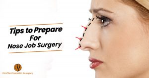 Tips to Prepare For Nose Job Surgery