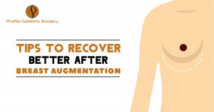 Tips to recovery better after Breast Augmentation
