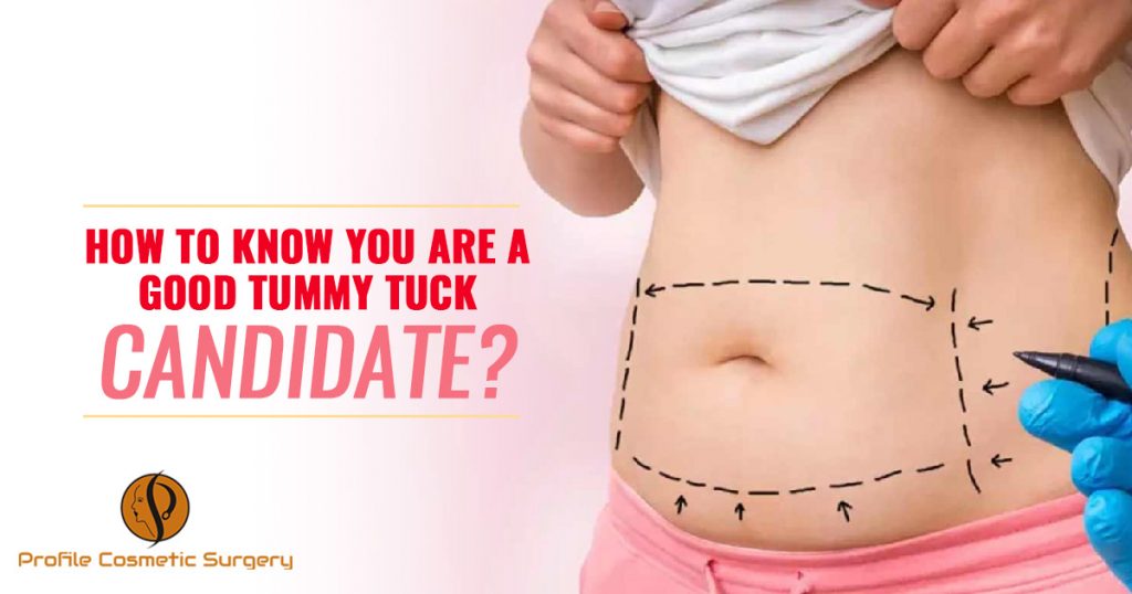 How to know you are a good Tummy Tuck Candidate