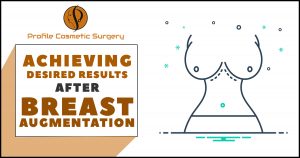 Achieving desired results after breast augmentation