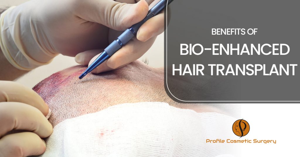 Benefits of Bio-enhanced hair transplant