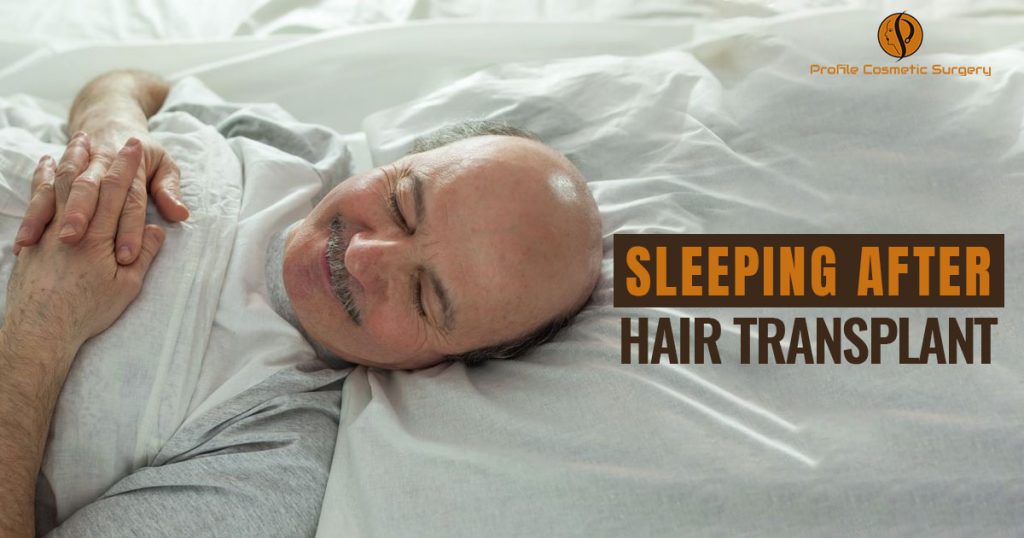 Sleeping after hair transplant