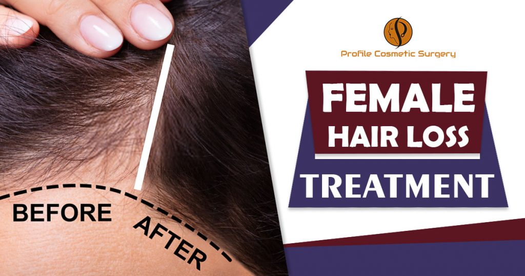 Treatment For Female Hair Loss in Punjab – Blog – Profile Studios