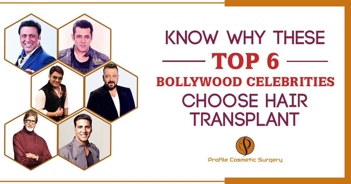 Know Why These Top 6 Bollywood Celebrities choose Hair Transplant – Blog –  Profile Studios