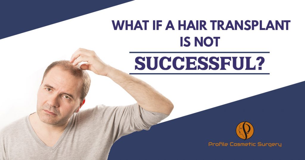 What if a hair transplant is not successful Punjab