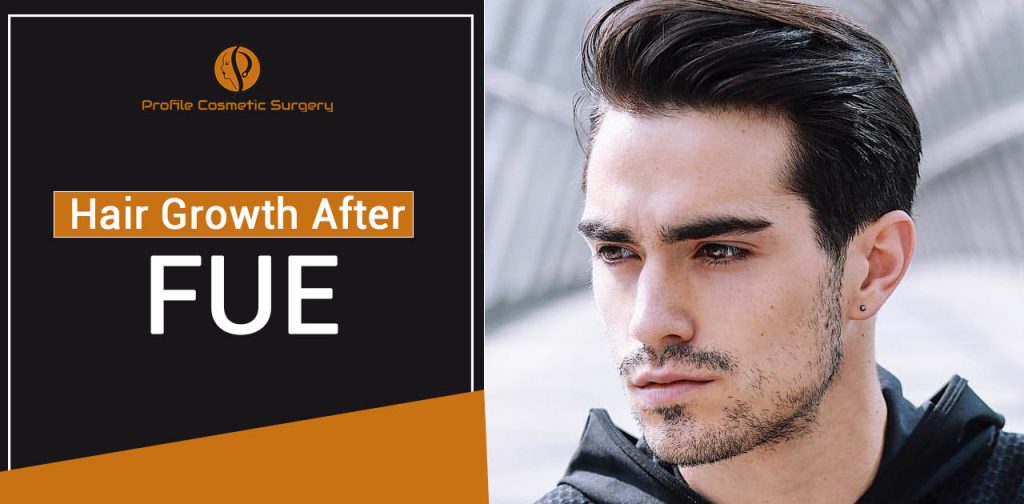 Everything you need to Know about hair growth after FUE hair transplant –  Blog – Profile Studios