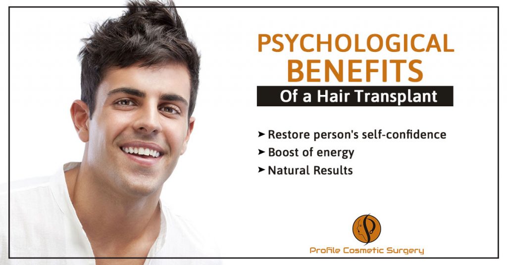 Psychological Benefits of a Hair Transplant