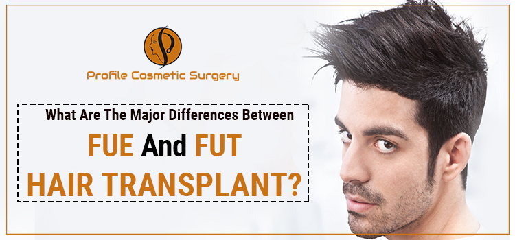 What-are-the-major-differences-between-FUE-and-FUT-hair-transplant