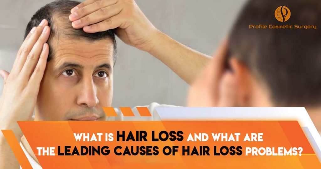 What is hair loss and what are the leading causes of hair loss problems