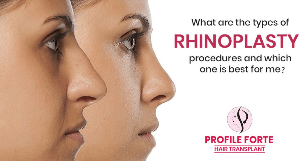 What are the types of rhinoplasty procedures and which one is best for me