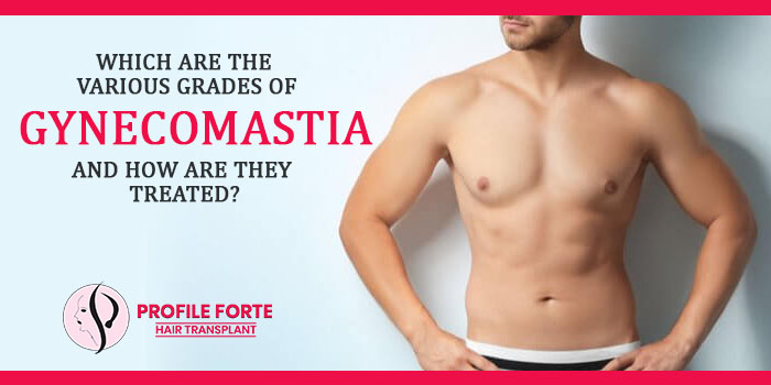 Which are the various grades of gynecomastia and how are they treated