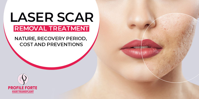 Laser scar removal treatment- Nature, Recovery period, Cost and Preventions