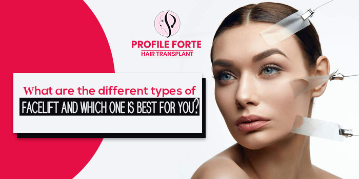 What are the different types of facelift and which one is best for you