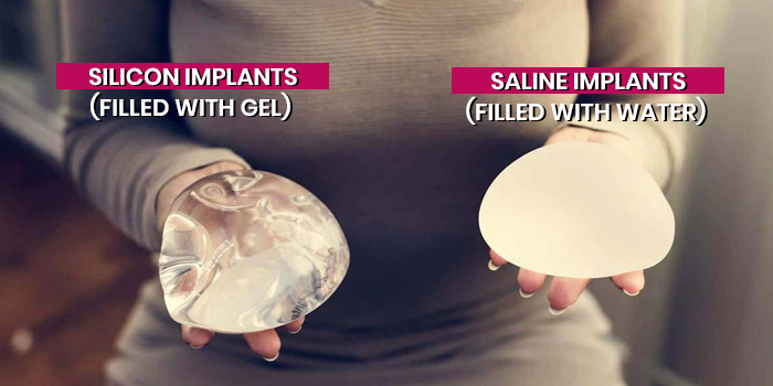 breast implant