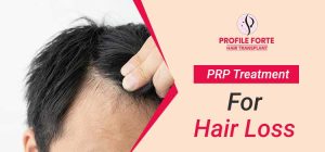 PRP-Treatment-for-hair-loss--profile