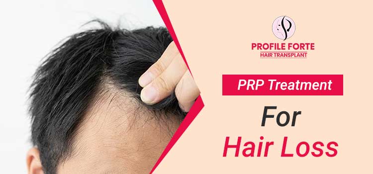 PRP-Treatment-for-hair-loss--profile