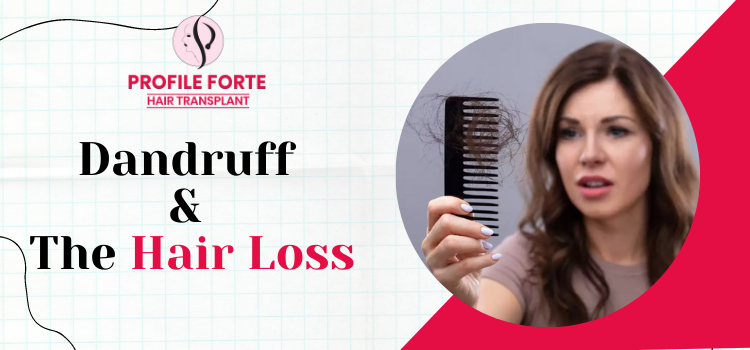 _Dandruff and the Hair loss