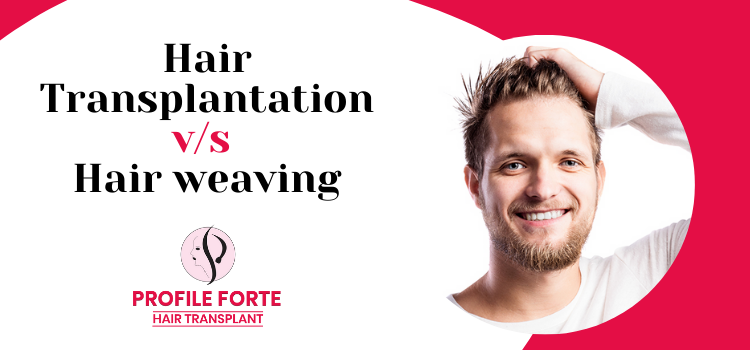 Hair transplantation vs Hair weaving