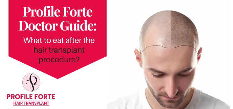 Profile Forte Doctor Guide What to eat after the hair transplant procedure