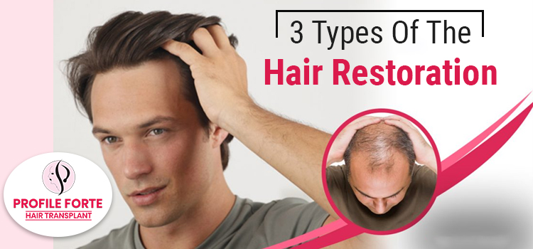 3-Types-Of-The-Hair-Restoration-Procedures