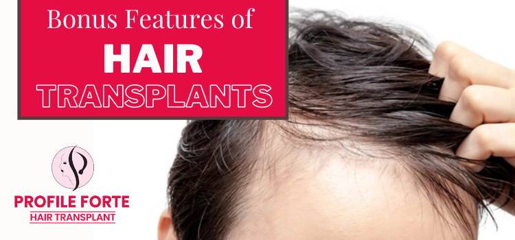 Bonus Features of Hair Transplants