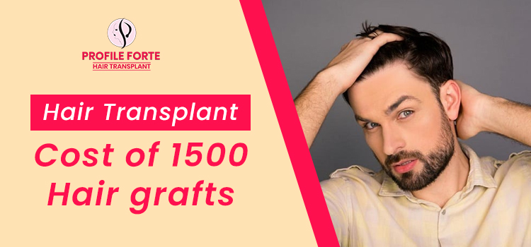 How much is the total cost of 1500 hair grafts for a hair transplant? –  Blog – Profile Studios