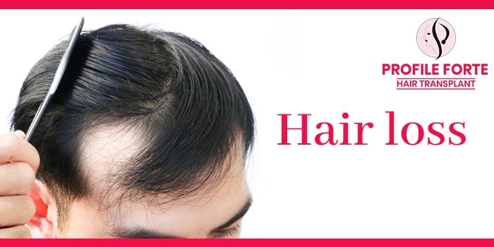 Diffuse Hair Thinning: What It Is, Its Common Signs, And Major Causes? –  Blog – Profile Studios