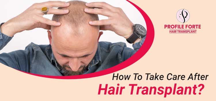 How-To-Take-Care-After-Hair-Transplant--profile