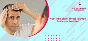 Hair Transplant Finest Solution To Revive Lost Hair