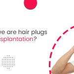 How effective are hair plugs for hair transplantation