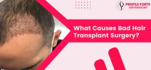 What Causes Bad Hair Transplant Surgery