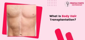 What Is Body Hair Transplantation