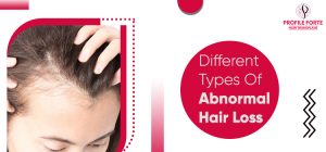 Different Types Of Abnormal Hair Loss