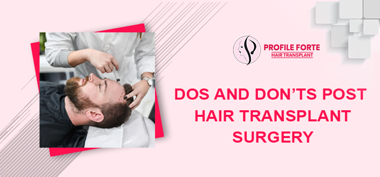Dos And Don’ts Post Hair Transplant Surgery