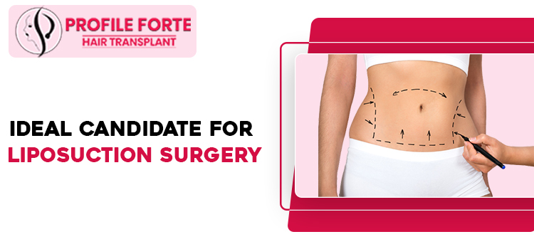 Liposuction-Surgery
