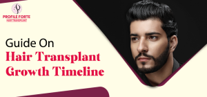 Hair Transplant Growth Timeline