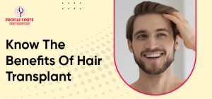 Know The Benefits Of Hair Transplant