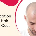 Get Clarification About The Hair Transplant Cost