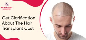 Get Clarification About The Hair Transplant Cost