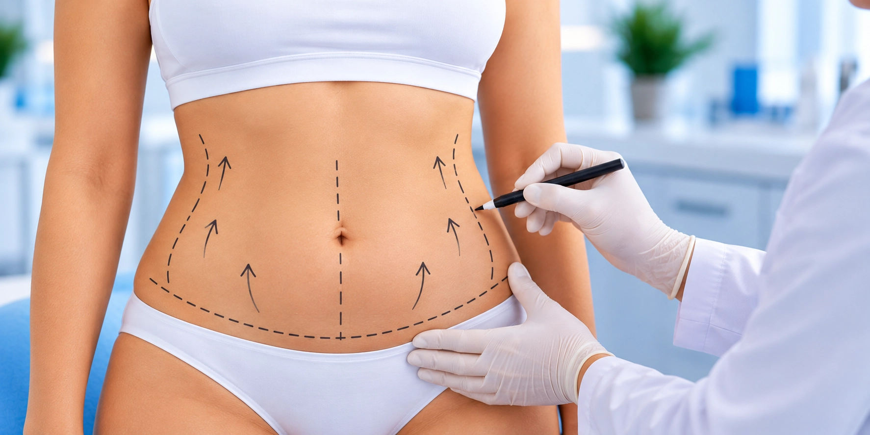 tummy-tuck