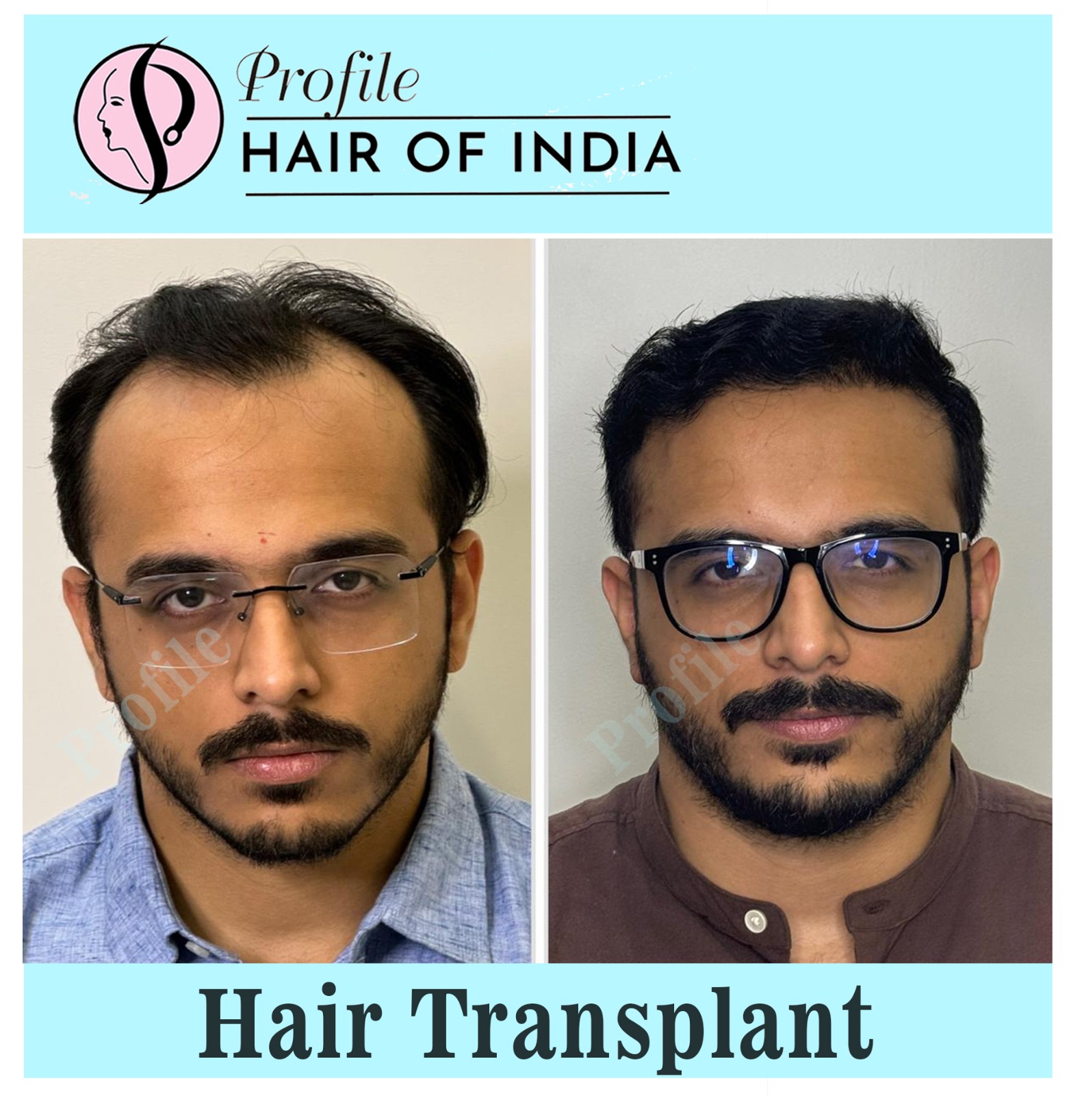 WhatsApp Image 2025-08-19 at 4.43.14 PM